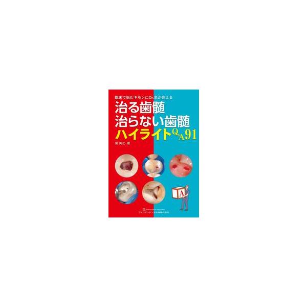 治る歯髄治らない歯髄ハイライトＱ＆Ａ９１　臨床で悩むギモンにＤｒ．泉が答える / 泉英之