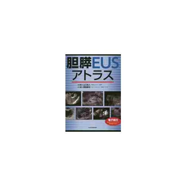 胆膵ＥＵＳアトラス / 山口　武人　監修・著