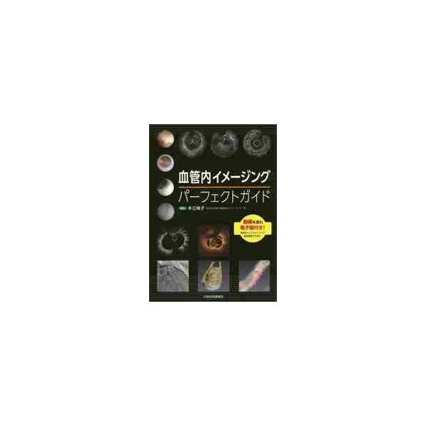 血管内イメージングパーフェクトガイド / 本江　純子　編著