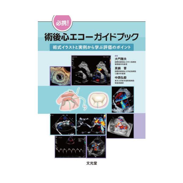 必携！術後心エコーガイドブック　術式イラストと実例から学ぶ評価のポイント / 大門雅夫