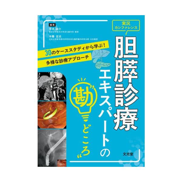 実況カンファレンス胆膵診療エキスパートの“勘どころ”　３０のケーススタディから学ぶ！多様な診療アプローチ / 中井陽介