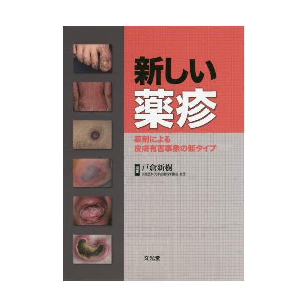 新しい薬疹　薬剤による皮膚有害事象の新タイプ / 戸倉　新樹　編集