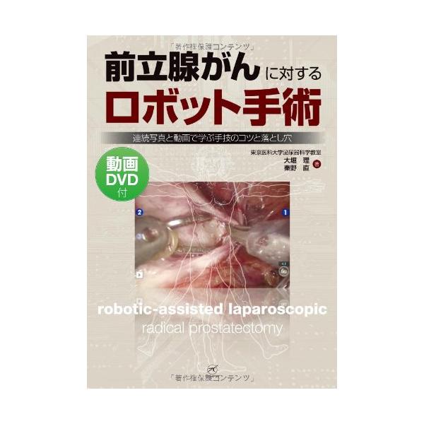 前立腺がんに対するロボット手術-連続写真と動画で学ぶ手技のコツと落とし穴-