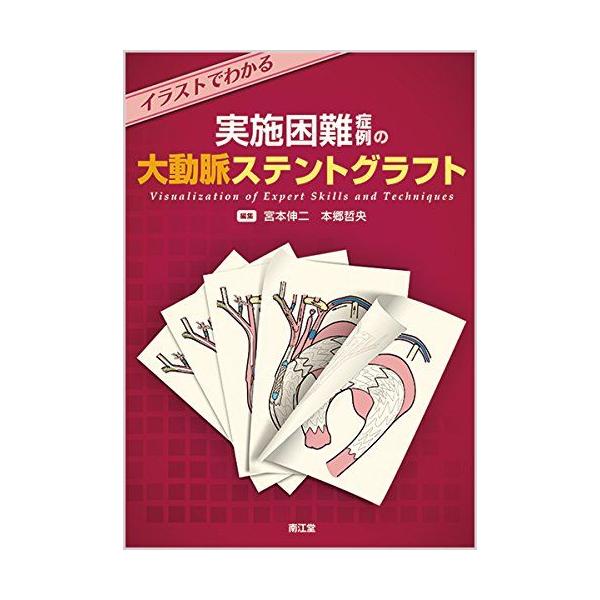 イラストでわかる実施困難症例の大動脈ステントグラフト 宮本 伸二; 本郷 哲央 イラストでわかる実施困難症例の大動脈ステントグラフト 宮本 伸二