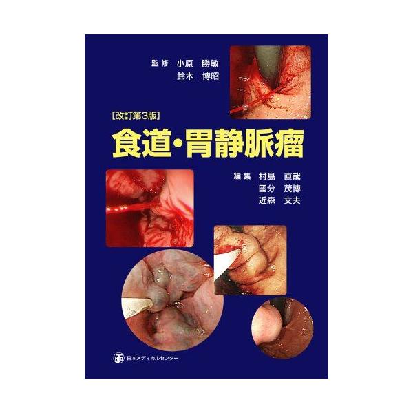 食道・胃静脈瘤 [単行本] 小原勝敏、 鈴木博昭、 村島直哉、 國分茂博; 近森文夫