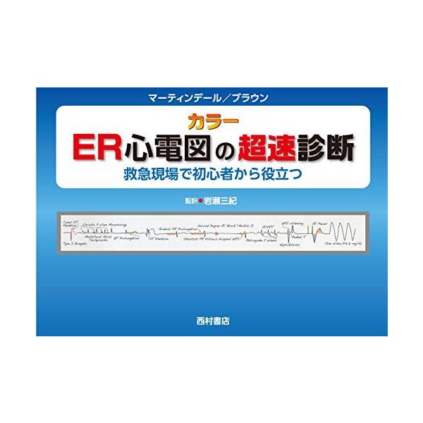 ER心電図の超速診断 ER心電図の超速診断 【公式通販】