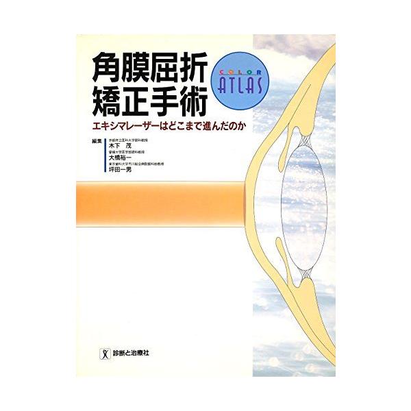 角膜屈折矯正手術-エキシマレーザーはどこまで進んだのか (カラーアトラス) 茂， 木下、 一男， 坪田; 裕一， 大橋