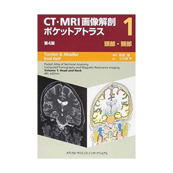 CT・MRI画像解剖ポケットアトラス 第4版 I巻 頭部・頸部 : ブックス