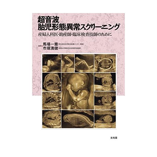 超音波胎児形態異常スクリーニング: 産婦人科医・助産師・臨床検査技師のために