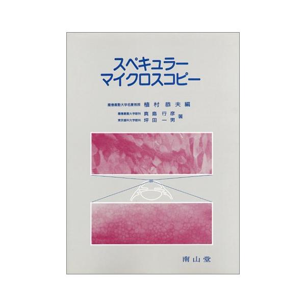 スペキュラ-マイクロスコピ- 植村 恭夫? 真島 行彦; 坪田 一男