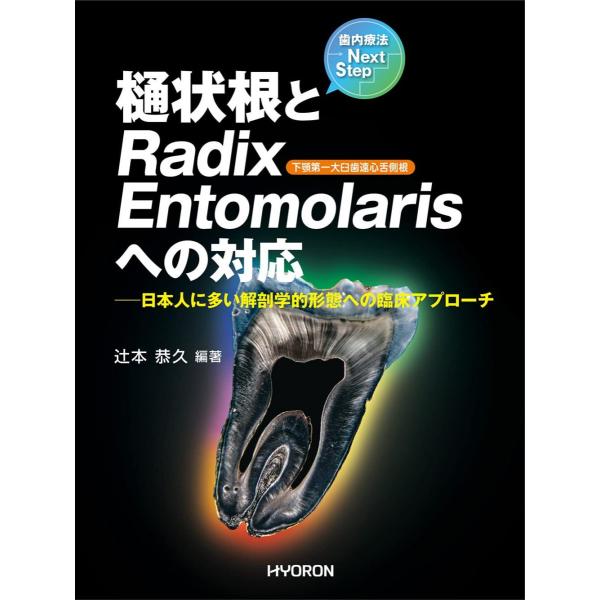歯内療法Next Step 樋状根とRadix Entomolarisへの対応 : ブックス