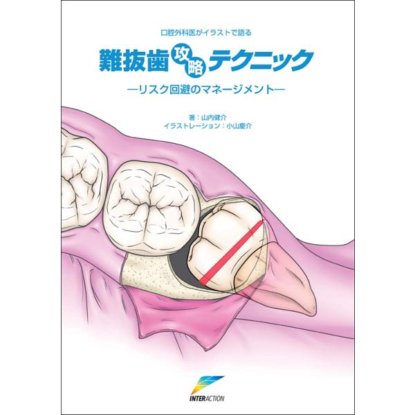 口腔外科医がイラストで語る難抜歯攻略テクニック: リスク回避のマネージメント