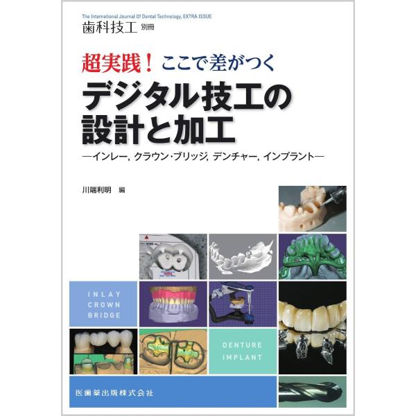 歯科技工別冊　超実践！ ここで差がつくデジタル技工の設計と加工 インレー，クラウン・ブリッジ，デンチャー，インプラント[雑誌] 川端 利明
