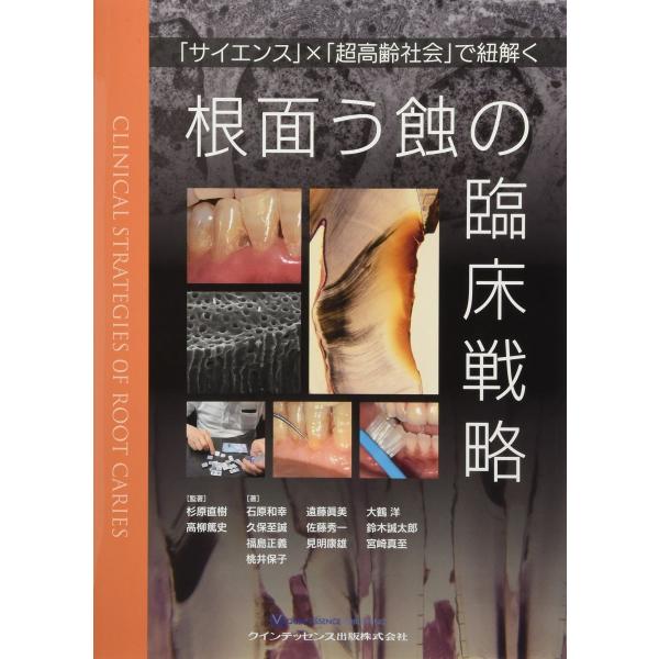 根面う蝕の臨床戦略 杉原 直樹 高柳 篤史 石原 和幸 遠藤 眞美 大鶴 洋 久保 至誠 佐藤 秀一 鈴木 誠太郎 福島 正義