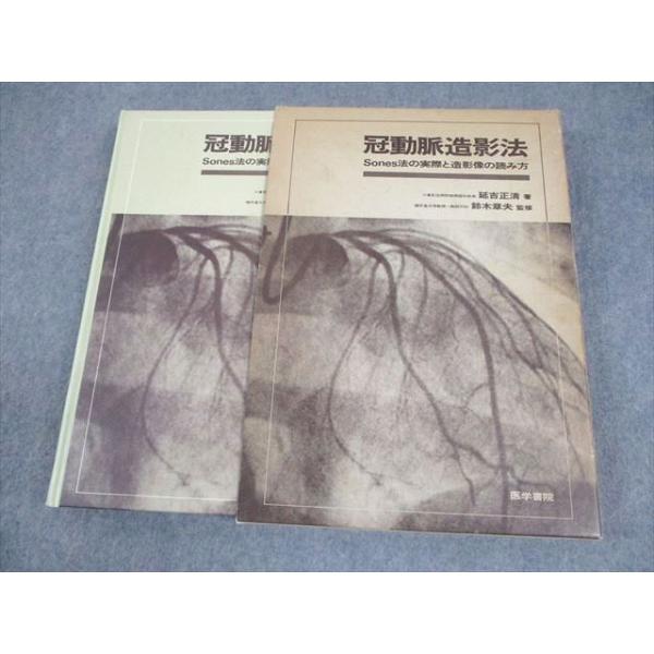 医学書院 冠動脈造影法 Sones法の実際と造影像の読み方 1982 延吉正清 033R6D