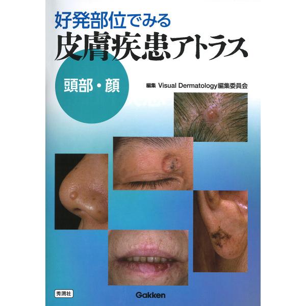 好発部位でみる皮膚疾患アトラス 頭部・顔/VisualDermatology編集委員会