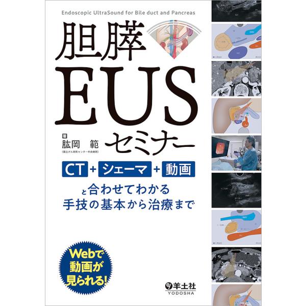 胆膵EUSセミナー CT+シェーマ+動画と合わせてわかる手技の基本から治療まで/肱岡範