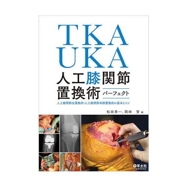 TKA・UKA人工膝関節置換術パーフェクト 人工膝関節全置換術・人工膝関節単顆置換術の基本とコツ/松田秀一/岡崎賢 :BK-4758118973:bookfan 通販 膝美日和(ひざびより)