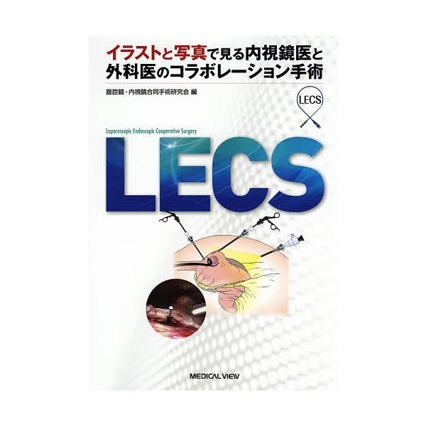 Lecs イラストと写真で見る内視鏡医と外科医のコラボレーション手術 腹腔鏡 内視鏡合同手術研究会 Bookfan Paypayモール店 通販 Paypayモール