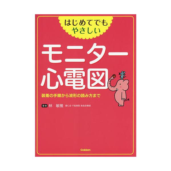 著:林敏雅出版社:学研メディカル秀潤社発売日:2014年07月キーワード:はじめてでもやさしいモニター心電図装着の手順から波形の読み方まで林敏雅 はじめてでもやさしいもにたーしんでんずそうちやくの ハジメテデモヤサシイモニターシンデンズソウ...