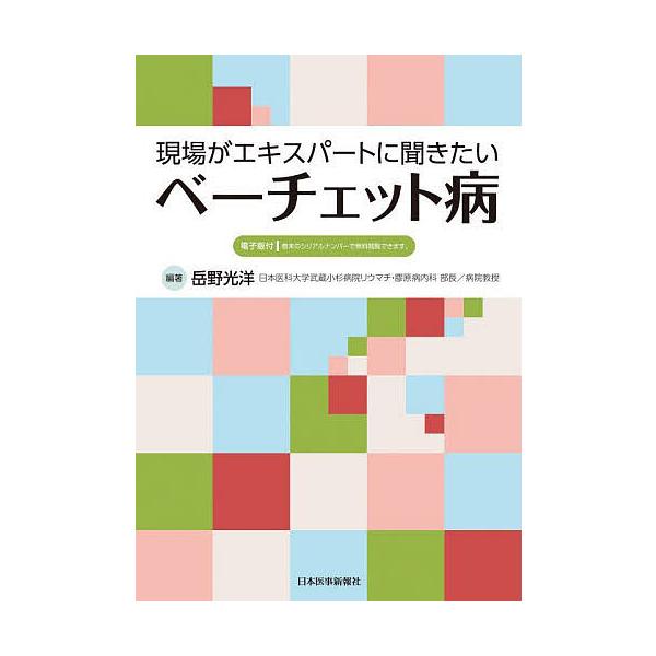 現場がエキスパートに聞きたいベーチェット病/岳野光洋