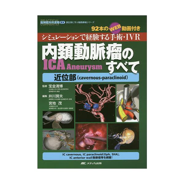 内頚動脈瘤（ICA Aneurysm）のすべて 内頚動脈瘤(ICA Aneurysm)のすべて-遠位部(supraclinoid