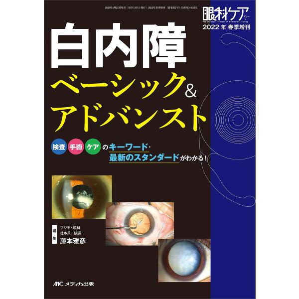 白内障ベーシック&アドバンスト 検査・手術・ケアのキーワード・最新のスタンダードがわかる!/藤本雅彦