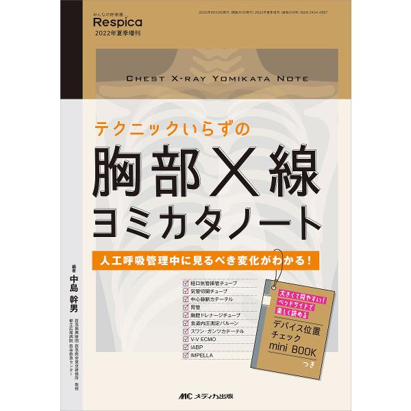 テクニックいらずの胸部X線ヨミカタノート 人工呼吸管理中に見るべき変化がわかる!/中島幹男