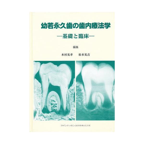 幼若永久歯の歯内療法学 基礎と臨床
