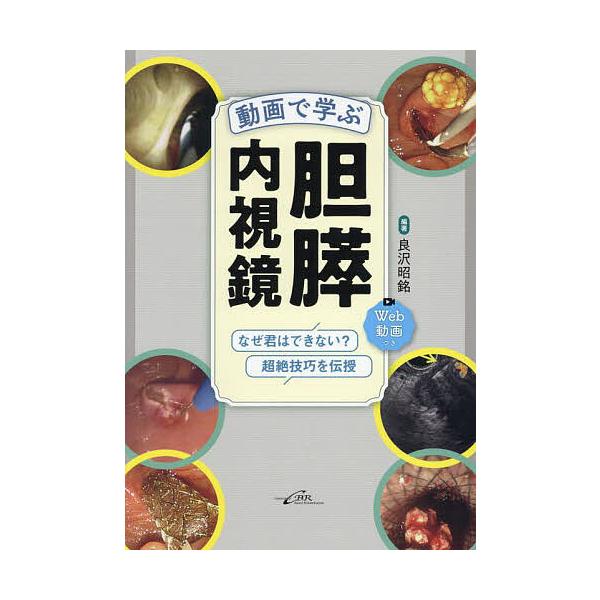 動画で学ぶ胆膵内視鏡 なぜ君はできない?超絶技巧を伝授/良沢昭銘