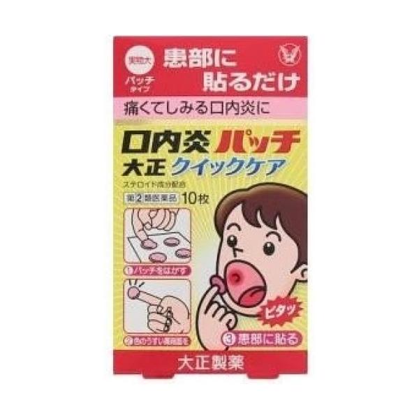 貼る口内炎治療薬です。口腔内ですぐれた付着力をもち、患部を刺激からしっかりカバーし、また、成分が持続的に作用します。