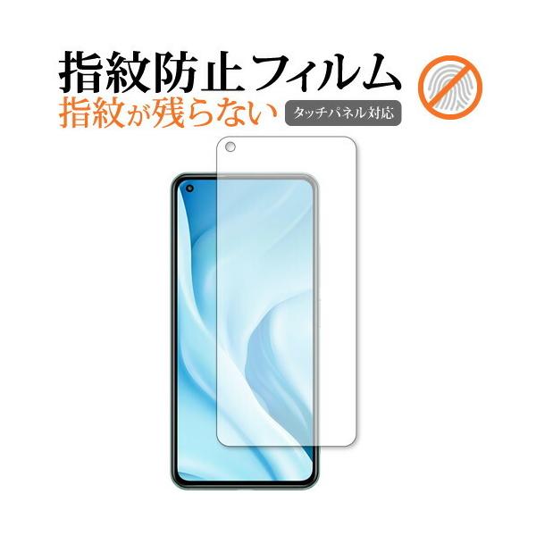 Xiaomi Mi 11 Lite 5G p wh~ NA یtB ʕی V[g [֑ ݊i