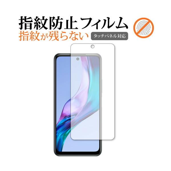 Xiaomi Redmi Note 10T ی tB wh~ NA ʕی V[g [֑ ݊i