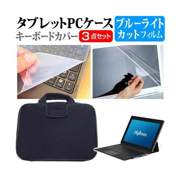 hXp Diginnos DGM-S12Y u[CgJbg wh~ t ی tB  Ռz ^ubgPCP[X Zbg P[X Jo[ ^ubgP[X ݊i