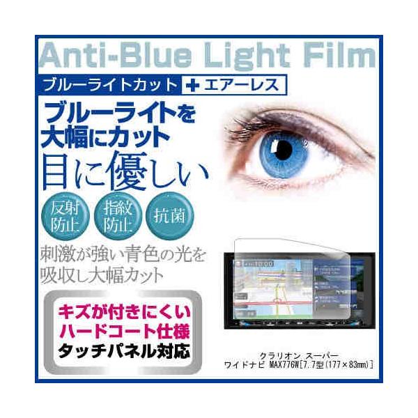 NI X[p[Chir MAX776W u[CgJbg ˖h~ t ی tB wh~ CAXH ݊i