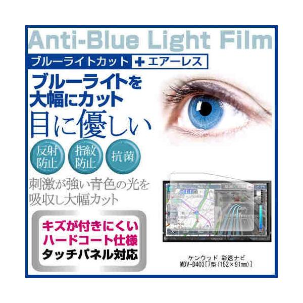 �P���E�b�h �ʑ��i�r MDV-D403 �u���[���C�g�J�b�g ���˖h�~ �t�� �ی� �t�B���� �w��h�~ �C�A���X���H �݊��i
