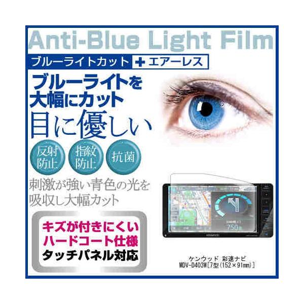 �P���E�b�h �ʑ��i�r MDV-D403W �u���[���C�g�J�b�g ���˖h�~ �t�� �ی� �t�B���� �w��h�~ �C�A���X���H �݊��i