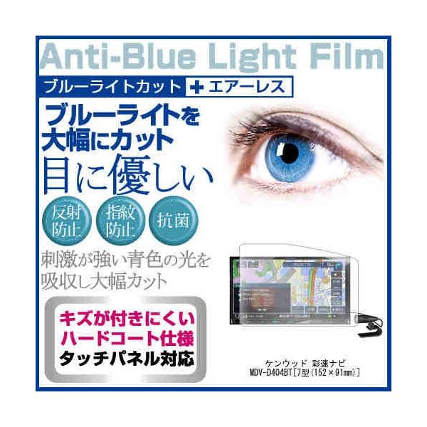 �P���E�b�h �ʑ��i�r MDV-D404BT �u���[���C�g�J�b�g ���˖h�~ �t�� �ی� �t�B���� �w��h�~ �C�A���X���H �݊��i