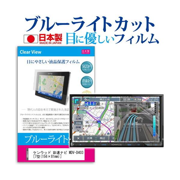 �P���E�b�h �ʑ��i�r MDV-D403 �u���[���C�g�J�b�g ���˖h�~ �t�� �ی� �t�B���� �w��h�~ �C�A���X���H �݊��i
