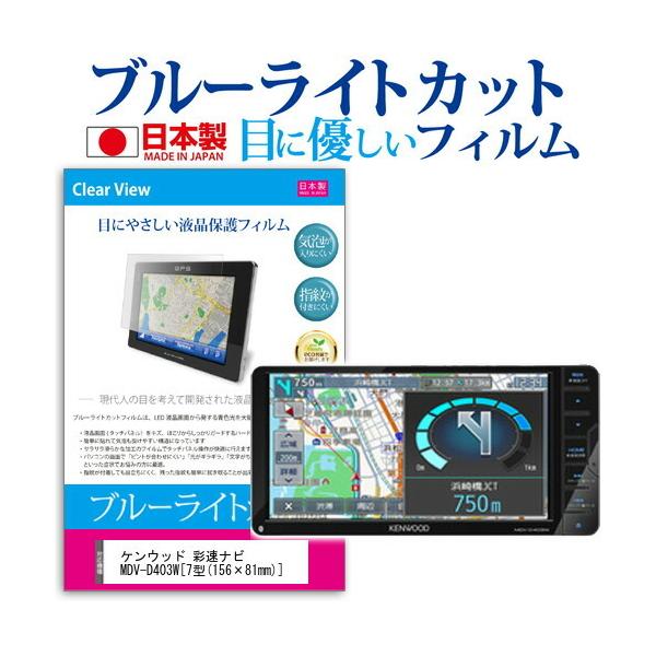 �P���E�b�h �ʑ��i�r MDV-D403W �u���[���C�g�J�b�g ���˖h�~ �t�� �ی� �t�B���� �w��h�~ �C�A���X���H �݊��i