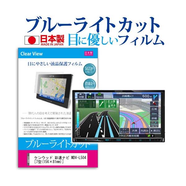 �P���E�b�h �ʑ��i�r MDV-L504 �u���[���C�g�J�b�g ���˖h�~ �t�� �ی� �t�B���� �w��h�~ �C�A���X���H �݊��i