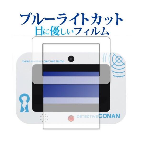 TRi i]gLPad / SEGA toys p u[CgJbg ˖h~ t ی tB wh~ ݊i