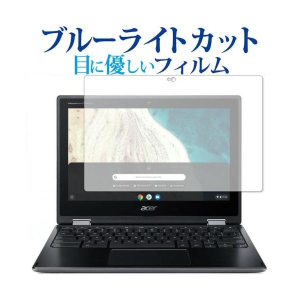 Acer Chromebook Spin 511 ��p �u���[���C�g�J�b�g ���˖h�~ �t�� �ی� �t�B���� �w��h�~ �݊��i