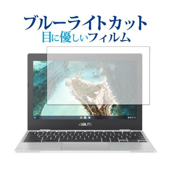 ASUS Chromebook CX1 (CX1100CNA) ��p �u���[���C�g�J�b�g ���˖h�~ �ی�t�B���� �w��h�~ �t���t�B���� ���[���֑������� �݊��i