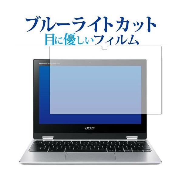 Acer Chromebook Spin 311 CP311-3H V[Y ی tB u[CgJbg ˖h~ یtB wh~ [֑ ݊i