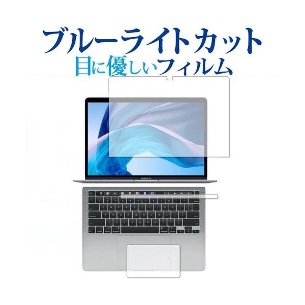 Apple MacBook Pro 13C`  2020 M1 tBR_Zbg t Touch BarV[g  gbNpbh  p u[CgJbg ˖h~ ی tB ݊i