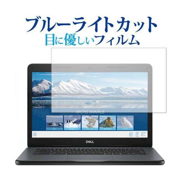DELL Chromebook 14 3400 Education ��p �u���[���C�g�J�b�g ���˖h�~ �t�� �ی� �t�B���� �݊��i