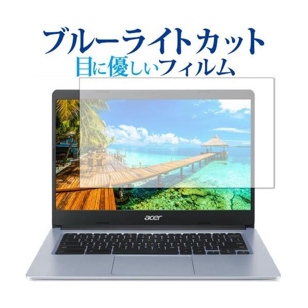 Acer Chromebook 314 (CB314-1H�V���[�Y) �ی� �t�B���� �u���[���C�g�J�b�g ���˖h�~ �ی�t�B���� �w��h�~ ���[���֑������� �݊��i