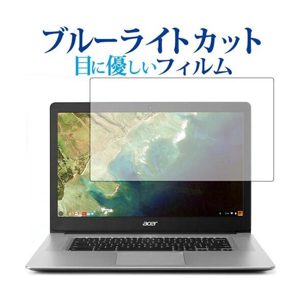 Acer Chromebook 15 CB515-1HT��p �u���[���C�g�J�b�g ���˖h�~ �t�� �ی� �t�B���� �w��h�~ �݊��i