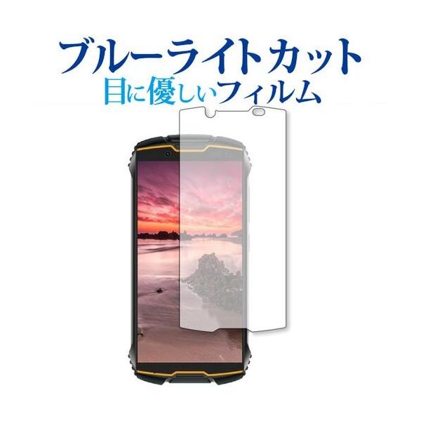 Cubot KingKong Mini 2 ��p �u���[���C�g�J�b�g ���˖h�~ �ی� �t�B���� �w��h�~  ���[���֑������� �݊��i